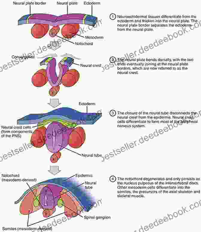 Diagram Of The Embryonic Human Nervous System Microneurosurgery Volume IVA: CNS Tumors: Surgical Anatomy Neuropathology Neuroradiology Neurophysiology Clinical Considerations Operability Treatment Options