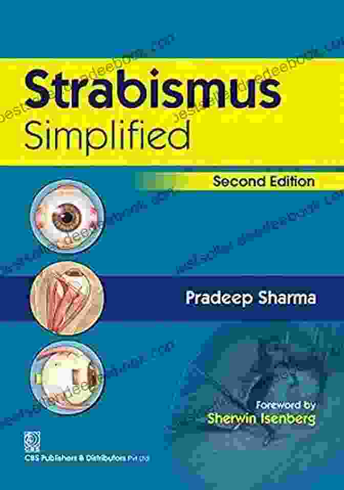 Strabismus Simplified Second Edition Mosby